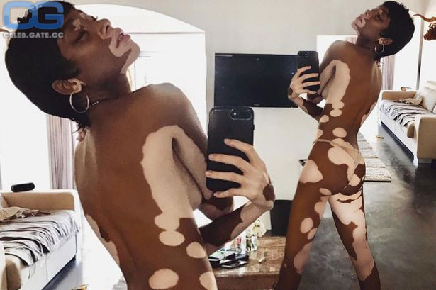 Winnie Harlow leaked nudes